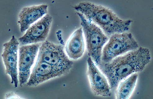 Hela細(xì)胞-輝駿生物 Hela細(xì)胞-輝駿生物